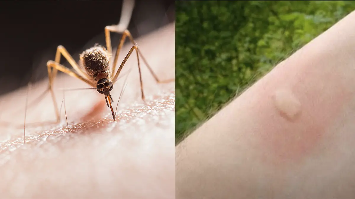 MOSQUITO