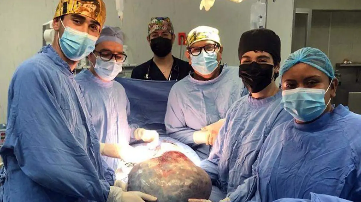Tumor _ CORTESÍA IMSS