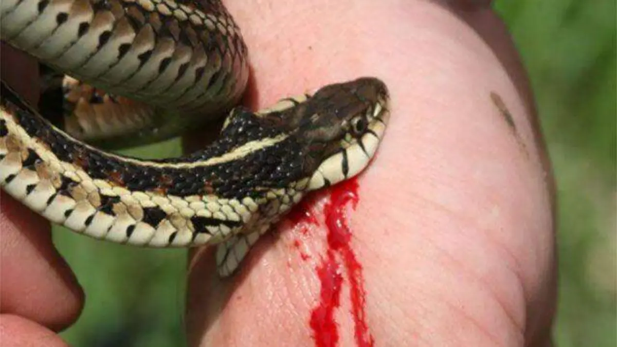 mordedura-de-serpiente.