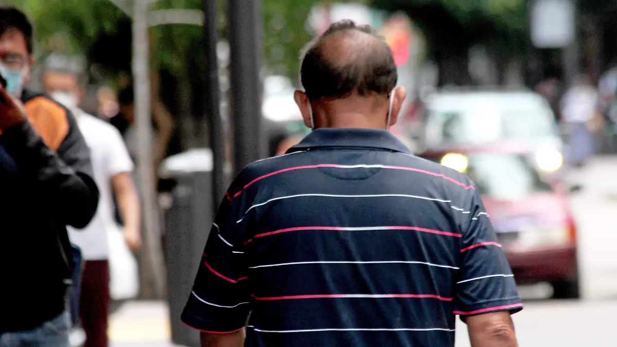 FCO MEZA-ALOPECIA (2)