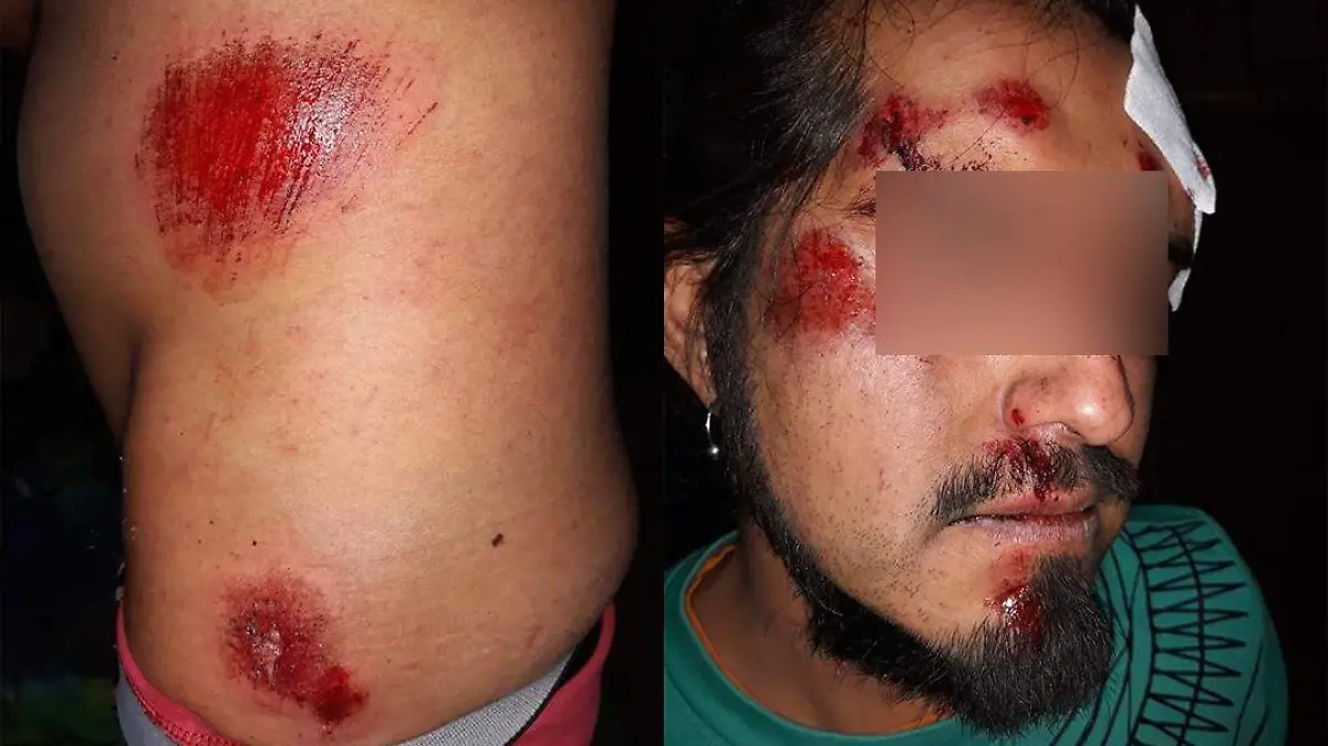 GOLPEADO (1)