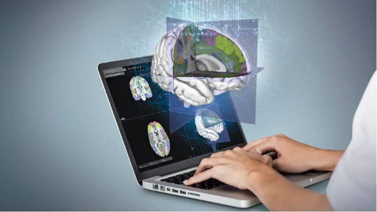 CErebro 3D
