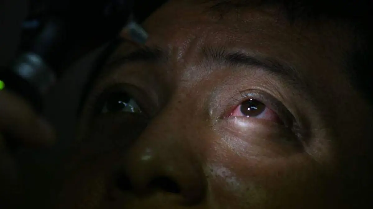 Campeche-Conjuntivitis-5