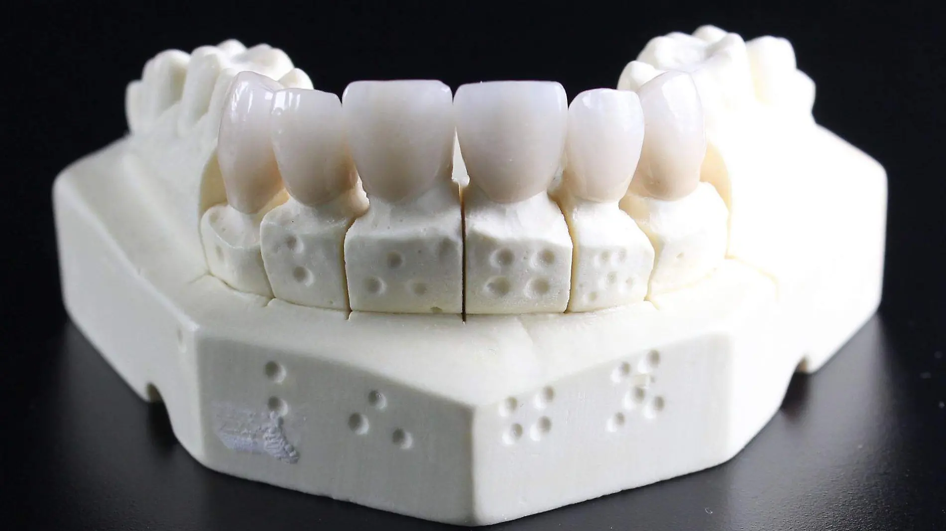 dentures-ge22415af7_1920