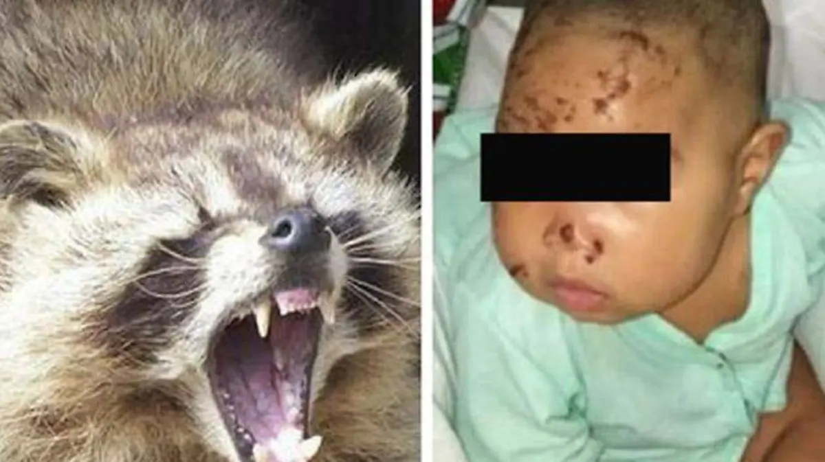 Mapache salvaje ataca a bebé de cuatro meses