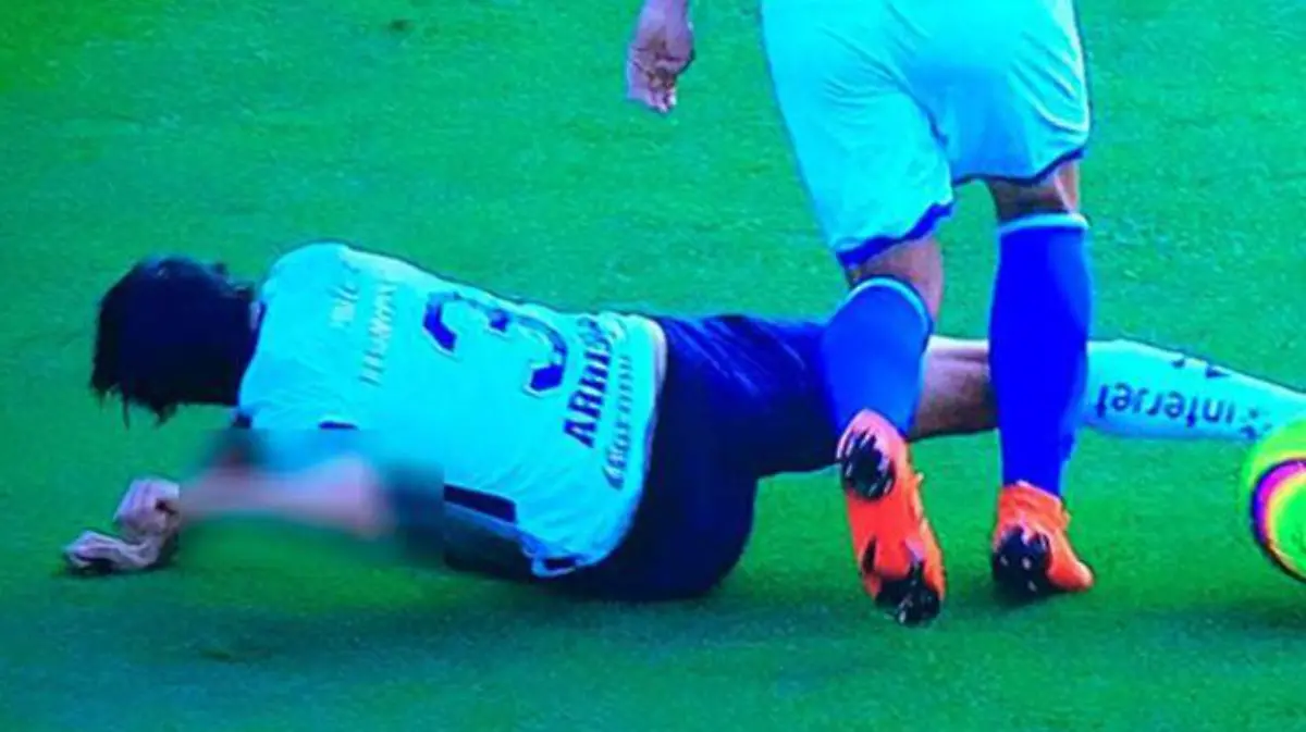 arribas-lesion-cruz-azul-pumas