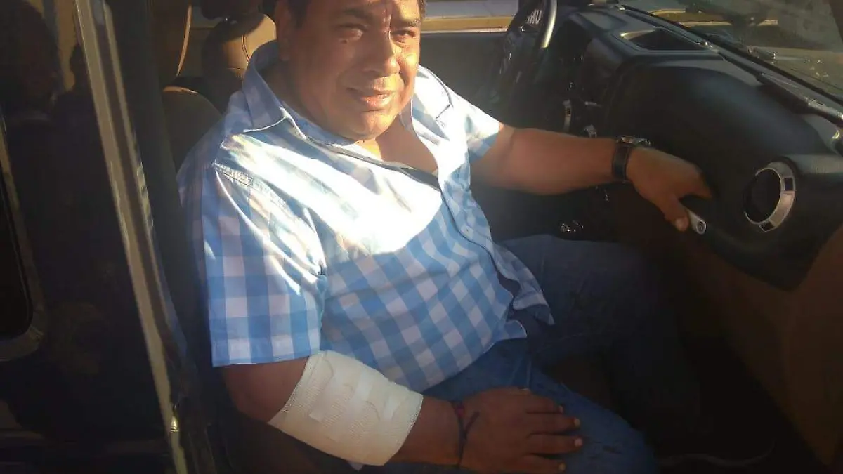 ataque periodista hiram moreno oaxaca (4)