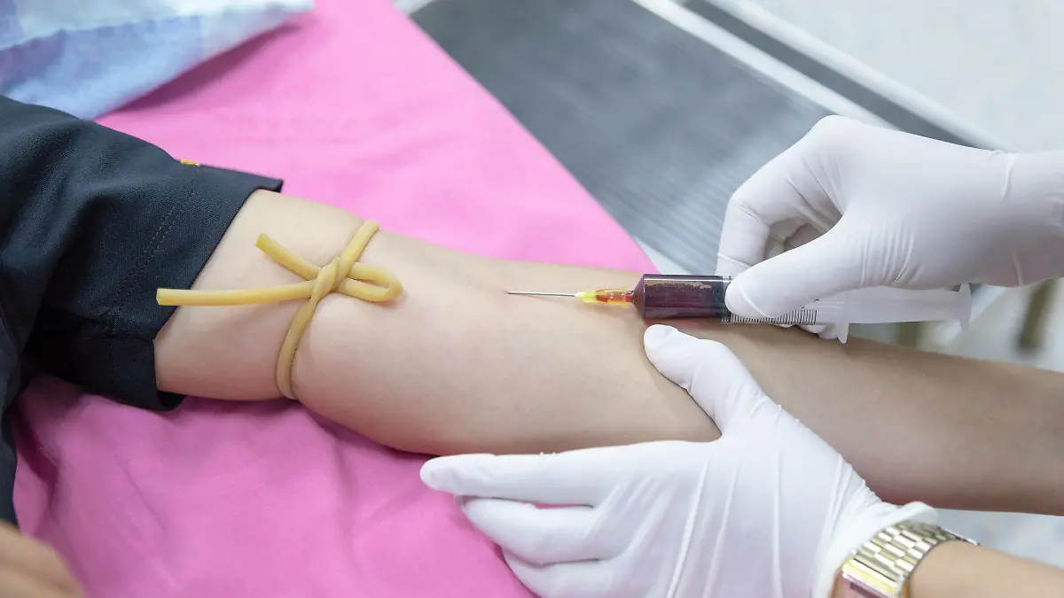 Brote de Klebsiella oxytoca (1)