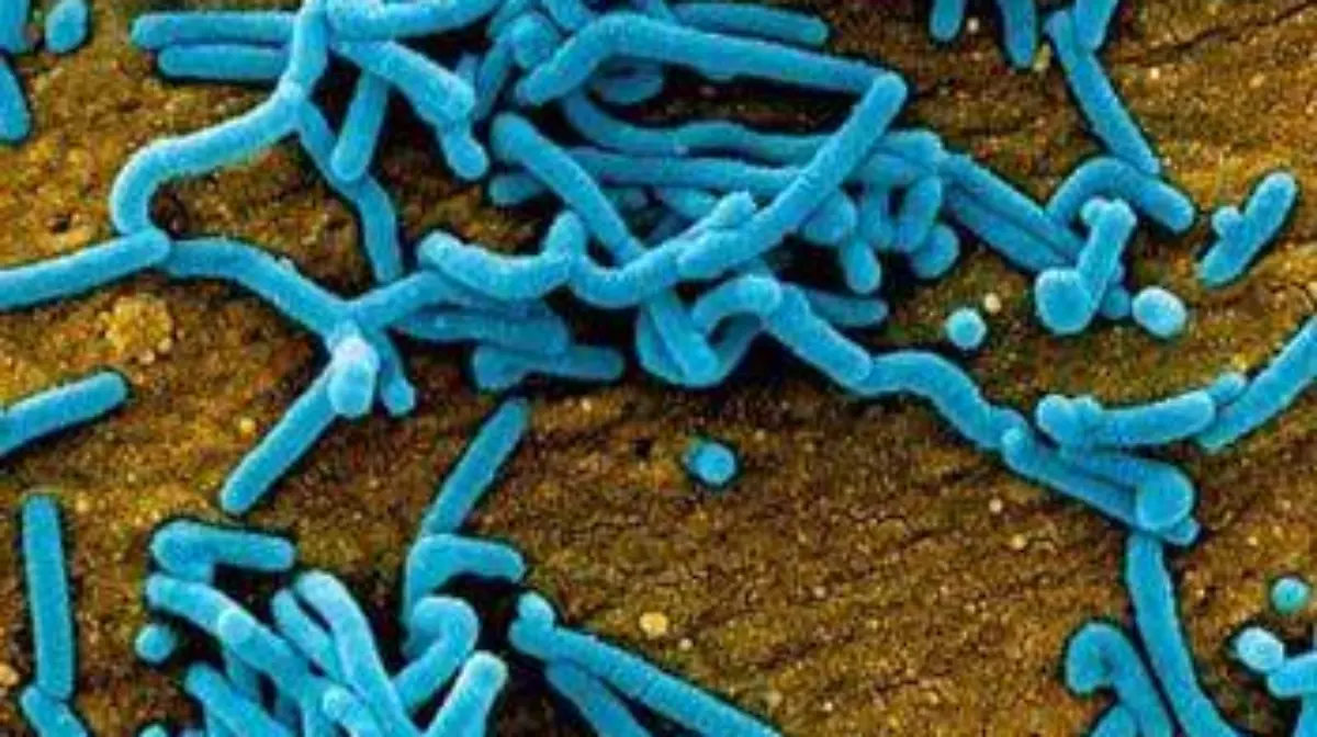 El virus del Marburgo visto desde el microscopio
