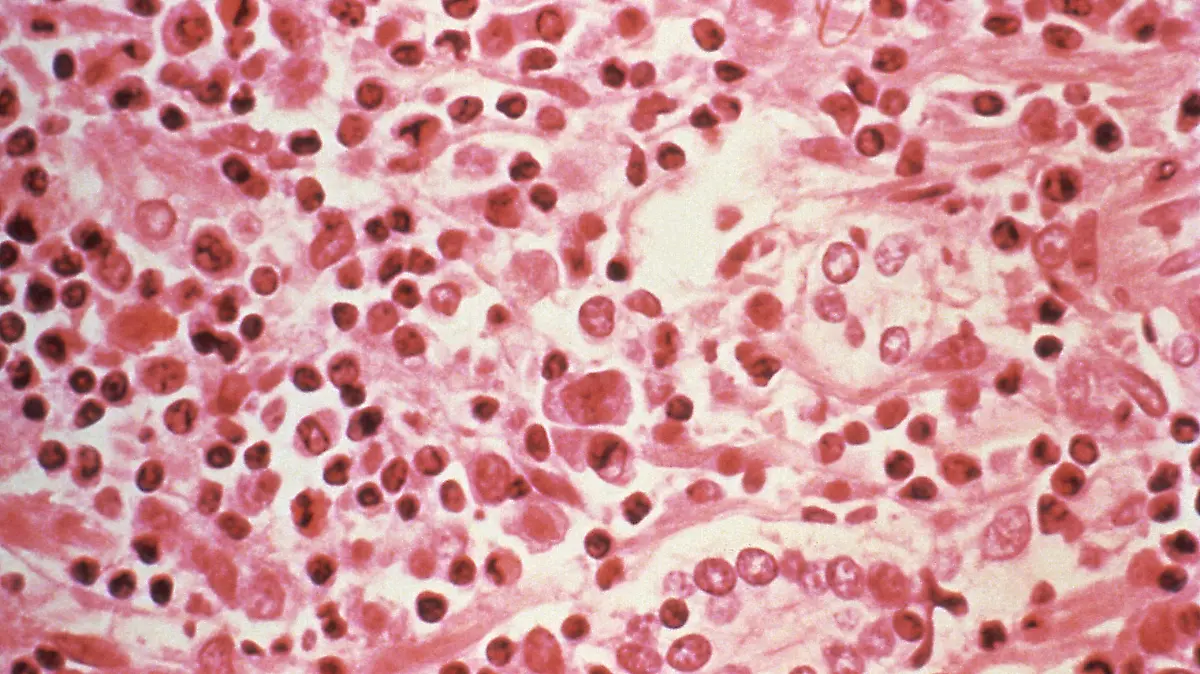 2026-05-04T105104Z_1606427421_RC292LA60NYK_RTRMADP_3_CRUISESHIP-HANTAVIRUS
