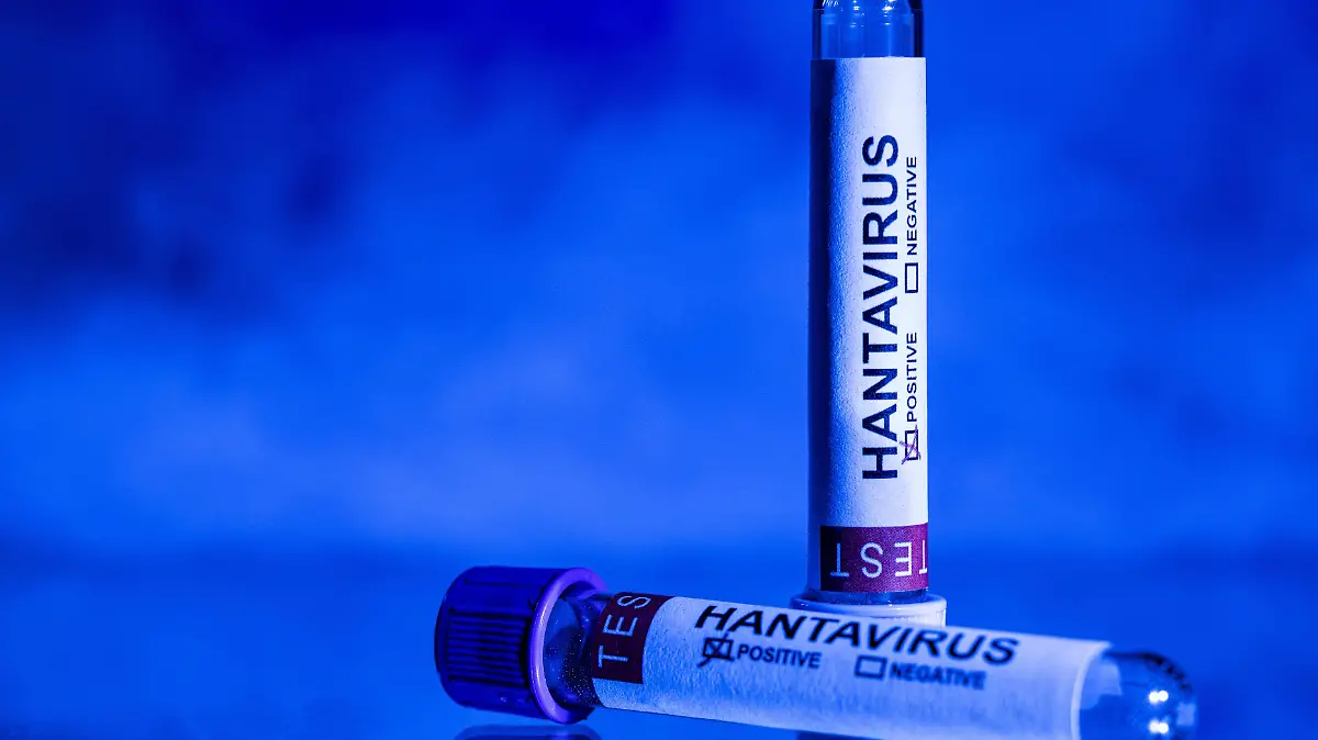 AFP__20260511__B2J262F__v3__HighRes__TopshotFranceHealthHantavirusIllnessIllustratio