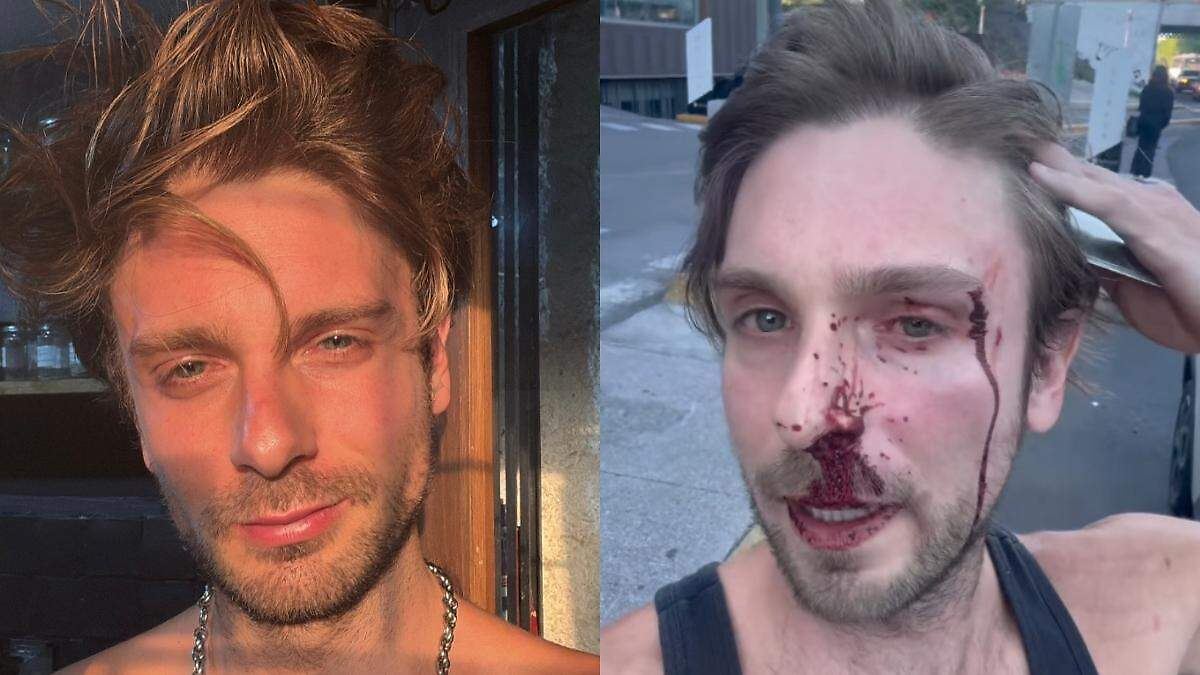 ACTOR DE TELEVISA, BRUTALMENTE AGREDIDO EN PERIFÉRICO