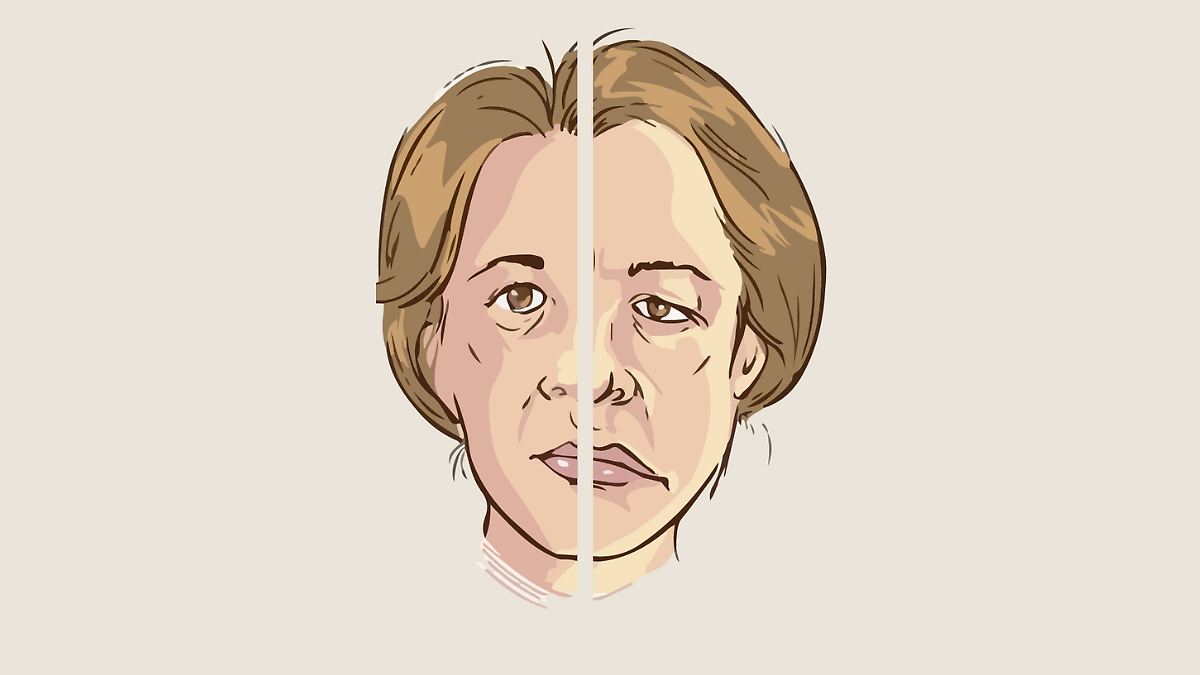 ¡MITO DESMENTIDO! EL AIRE FRÍO NO CAUSA PARÁLISIS FACIAL