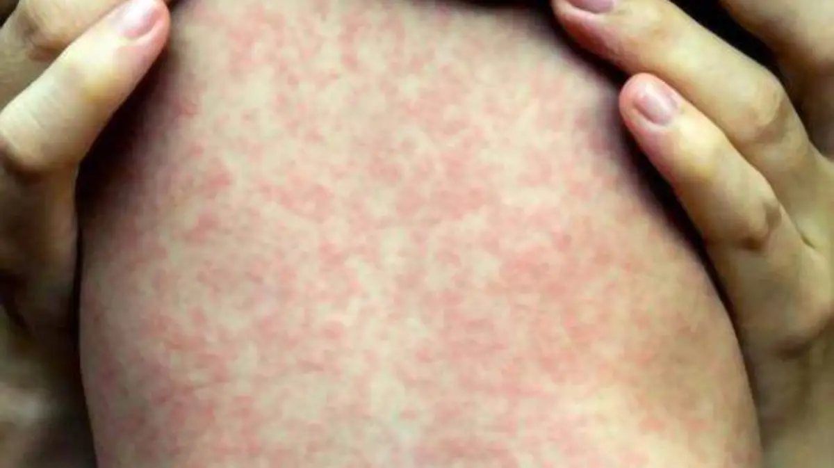 WhatsApp Image 2025-06-03 at 12.28.47