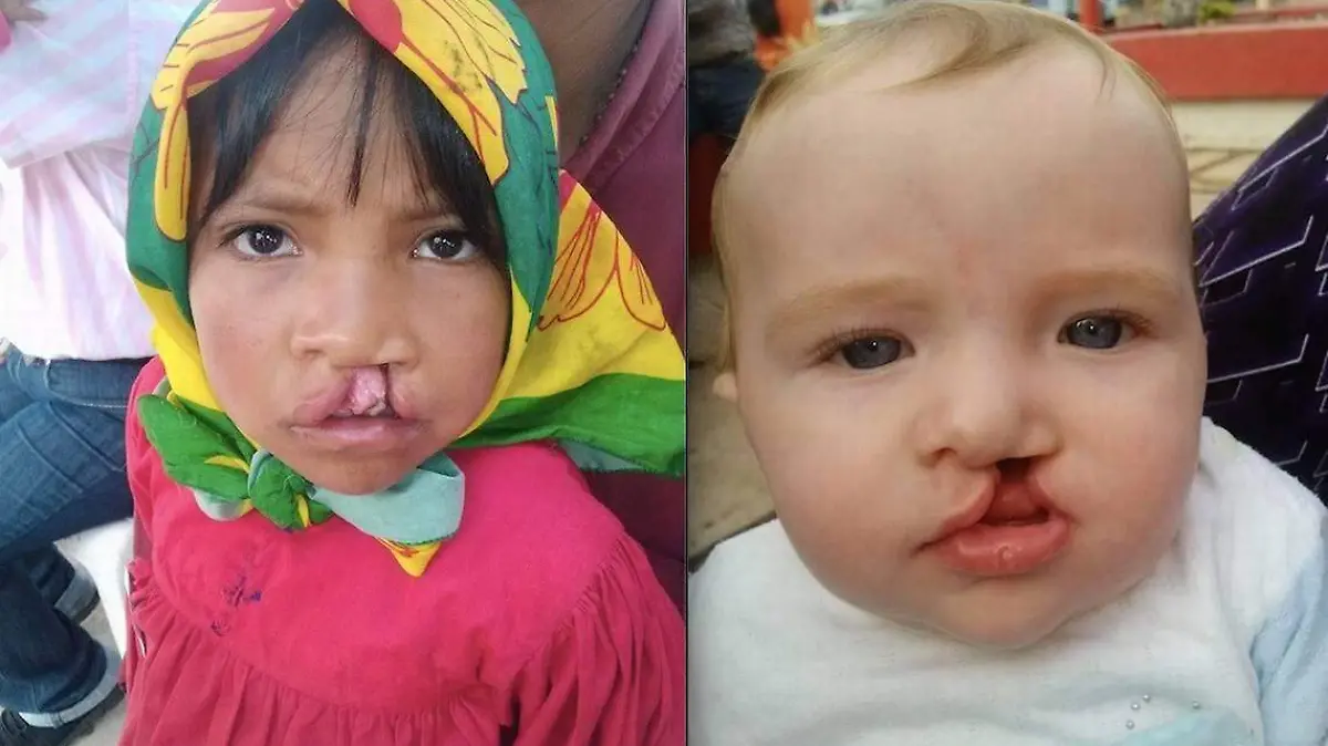 leporino gorki cortesia el heraldo de chihuahua