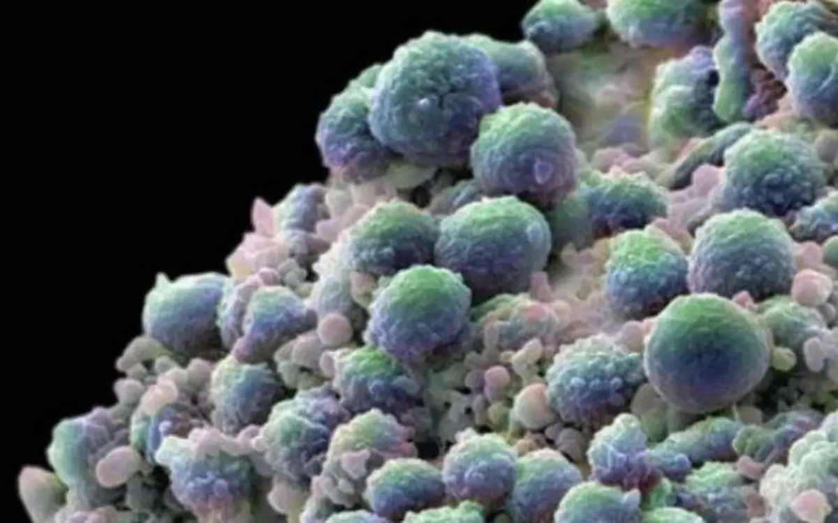 WhatsApp Image 2020-07-07 at 2.38.12 PM