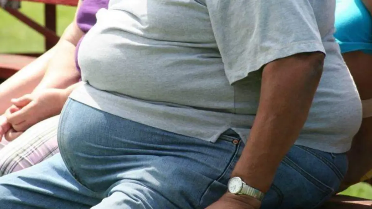 obesidad