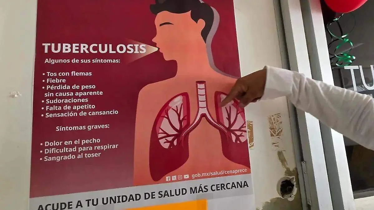 tuberculosis síntomas