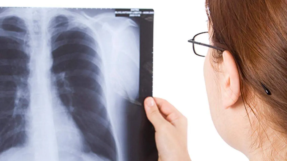 Doctor_viewing_xray_1200x675