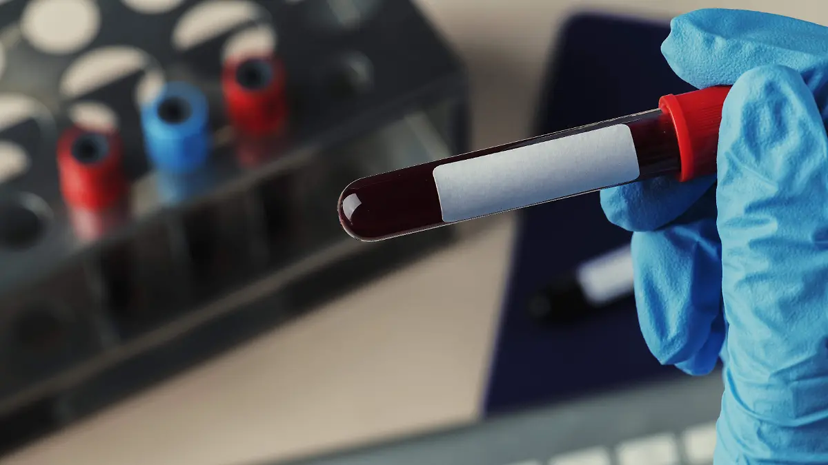 surgeon-holding-coronavirus-blood-test-tube