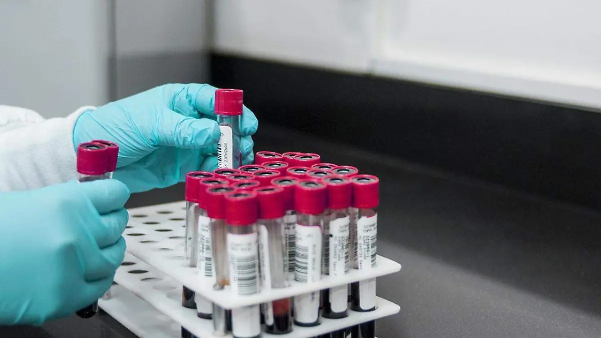 La entidad poblana ocupa el sexto lugar a nivel nacional en diagnósticos de salmonelosis