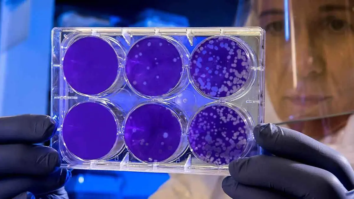 Una de las infecciones de transmisión sexual más comunes en el mundo es el Virus del Papiloma Humano (VPH)