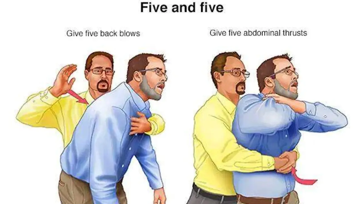 Aunque existen modos de actuar ante situaciones especiales, la manera en general de actuar es buscar la expulsión del objeto