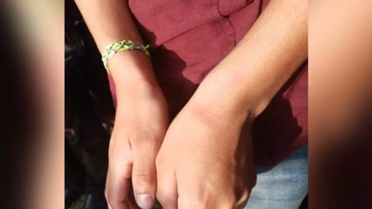 agresion policias cuautlancingo