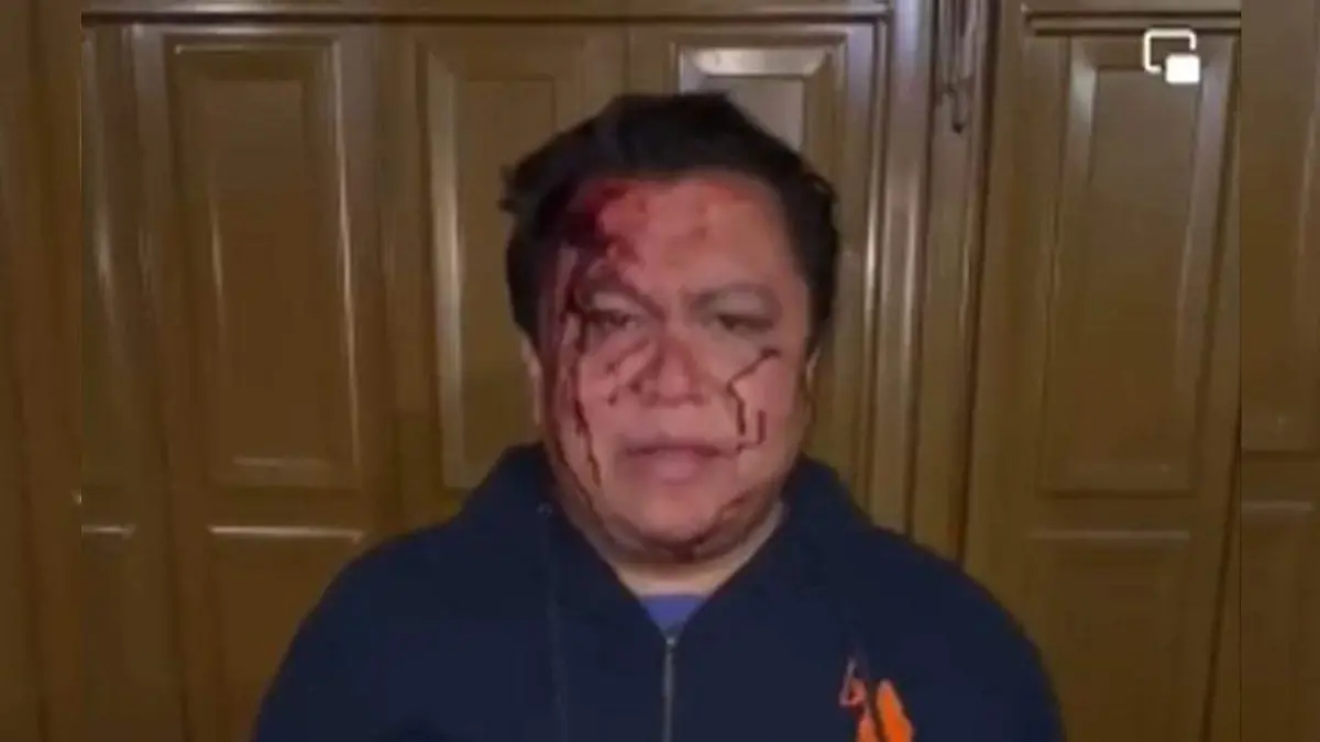 gonzalo juárez golpeado