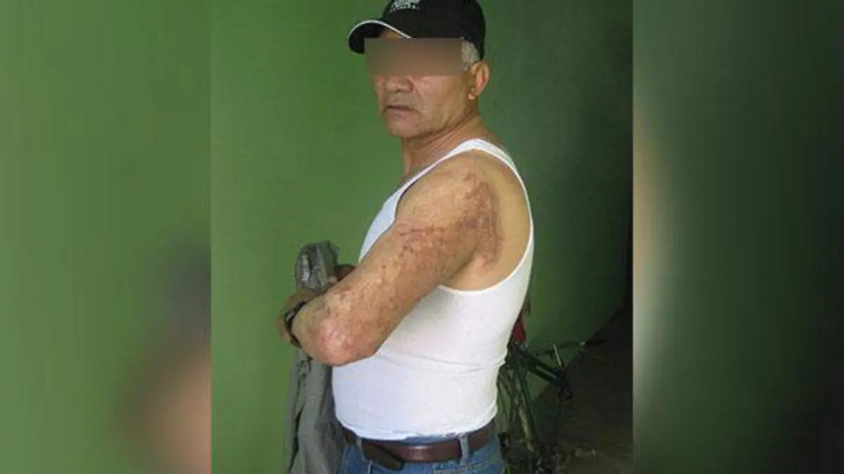 SOBREVIVIENTES DE LA EXPLOSIÓN