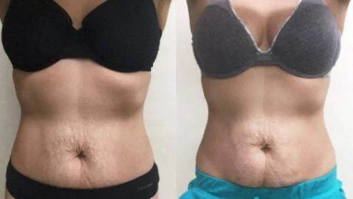 CARBOSSI_ESTRIAS_1454