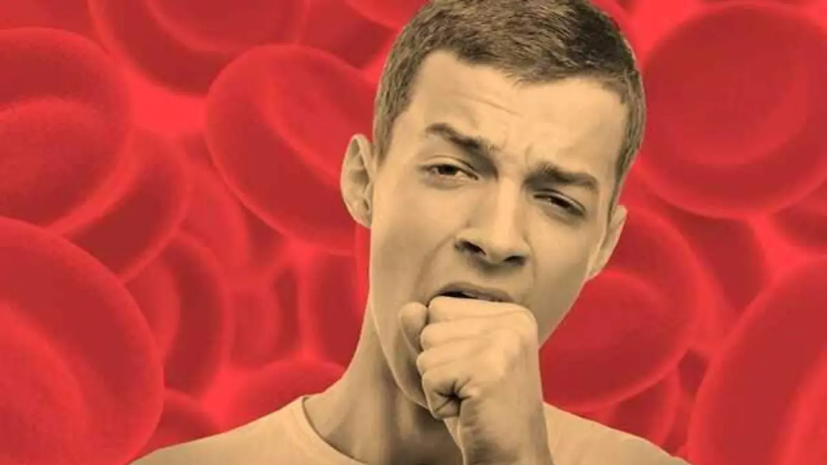 03-signs-of-anemia
