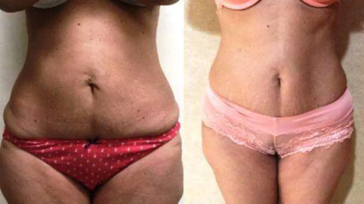 CARBOSSI_1786_censored