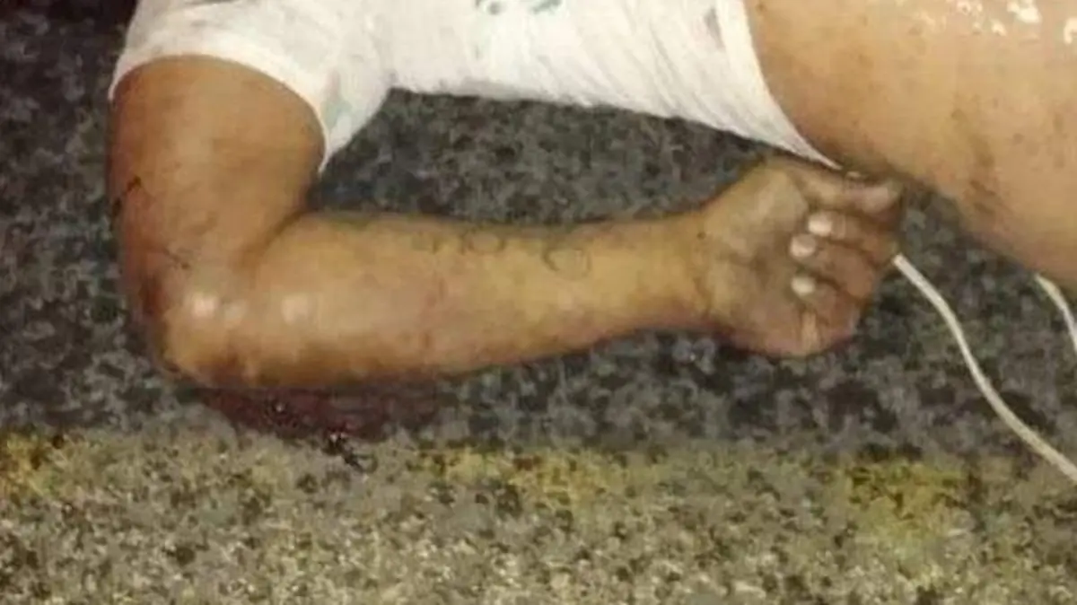 MUERE TRAS IMPACTO EN MOTO EN CHIETLA