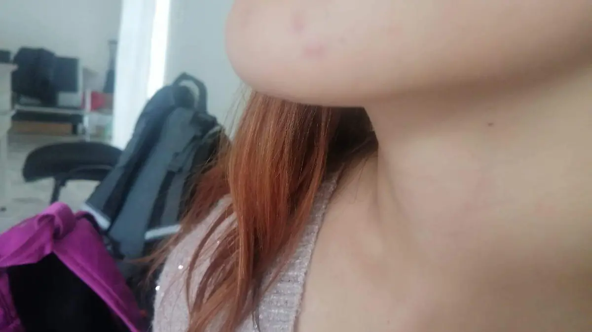 ESTUDIANTE AGREDIDA 02