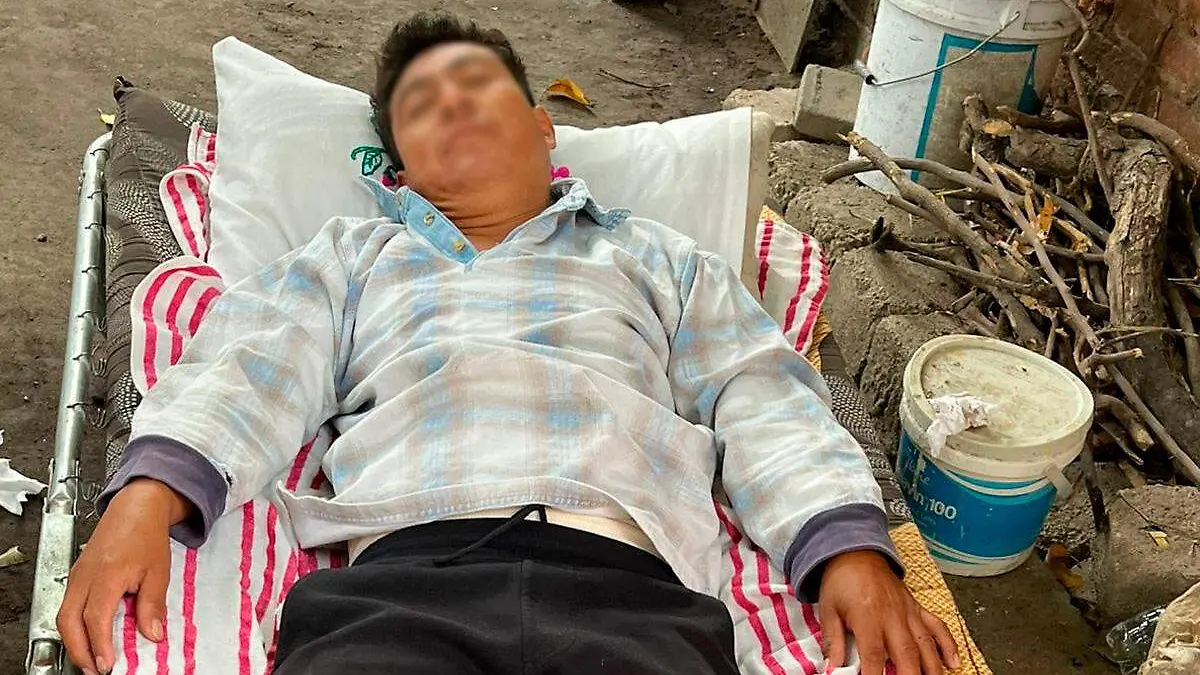 hombre accidentado en Atzala1