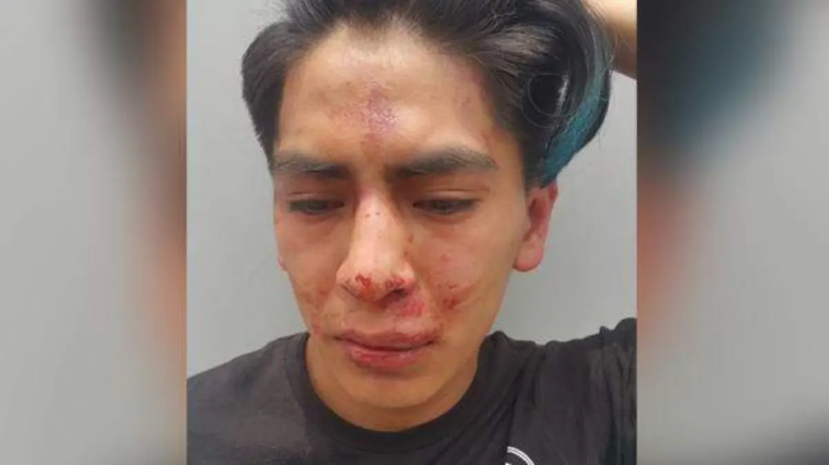 joven agredido