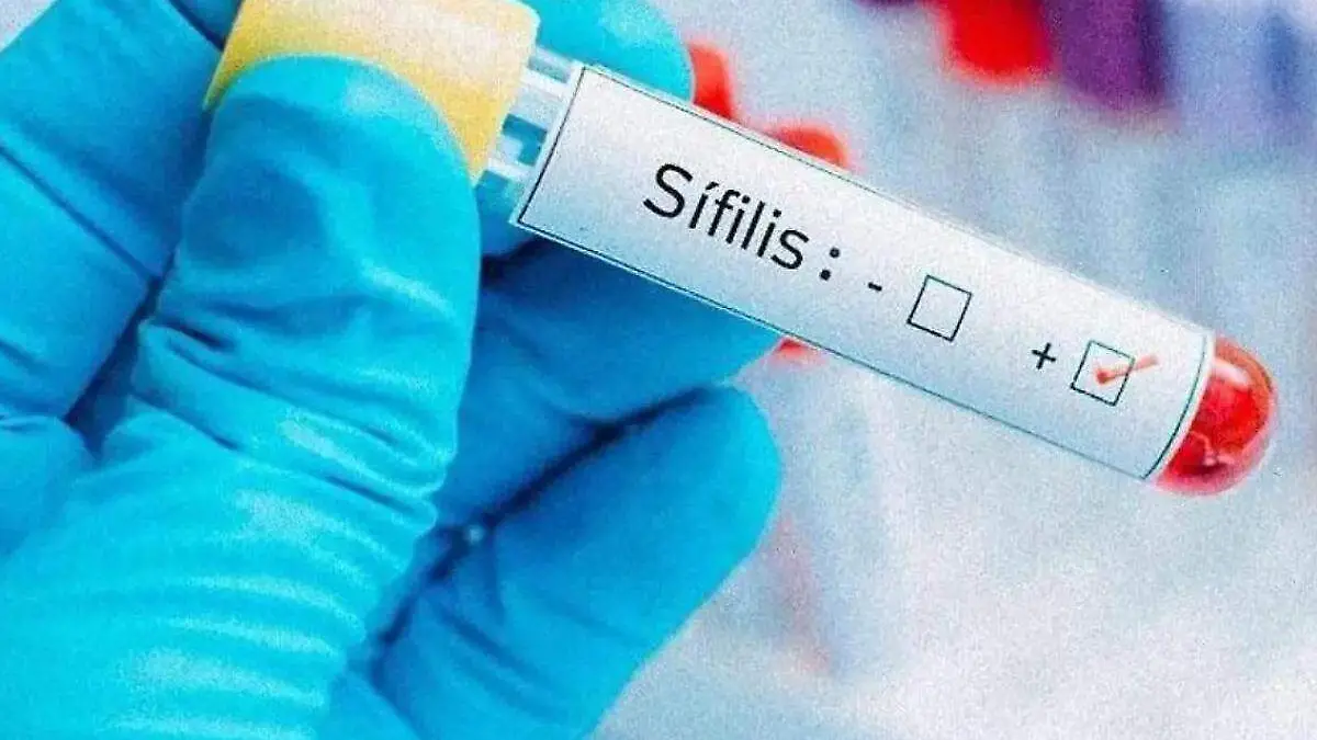 casos de sifilis