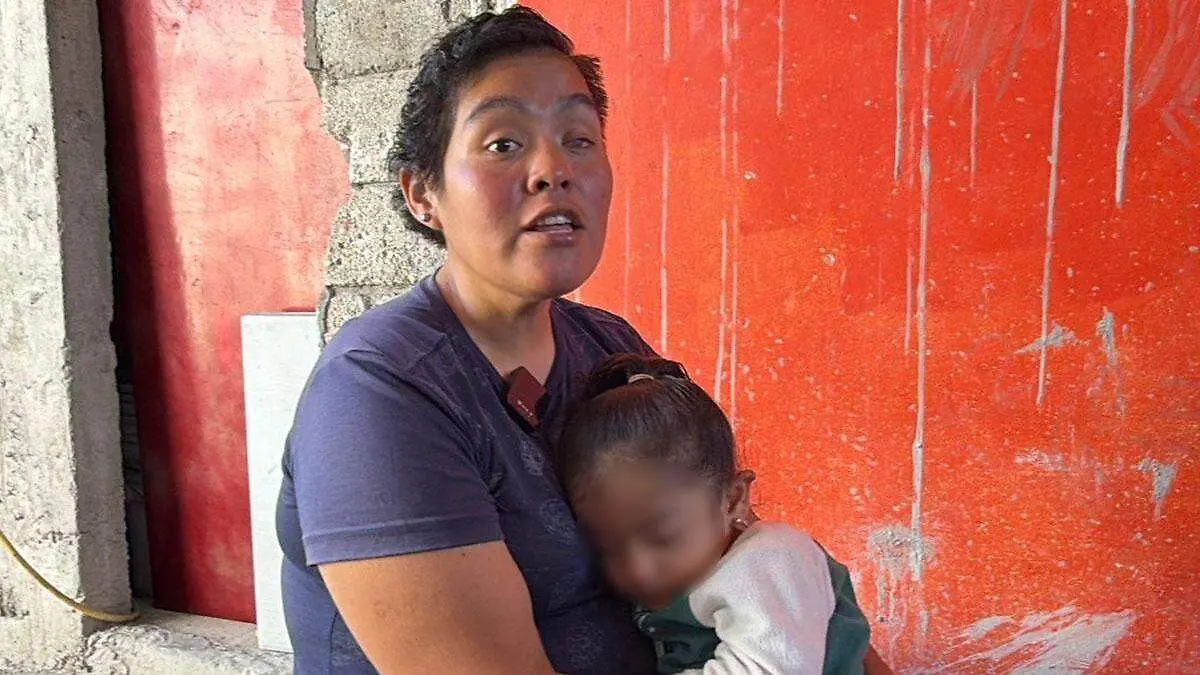 madre de izucar pide apoyo económico para operar a su hija 