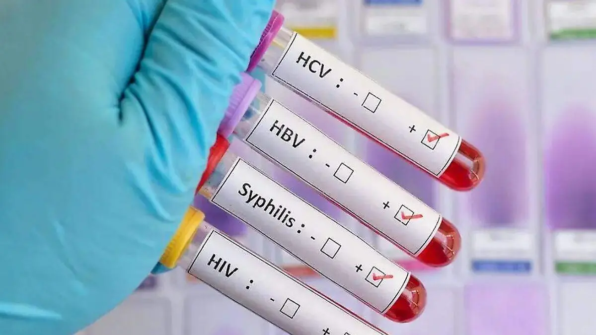 enfermedades de transmision sexual