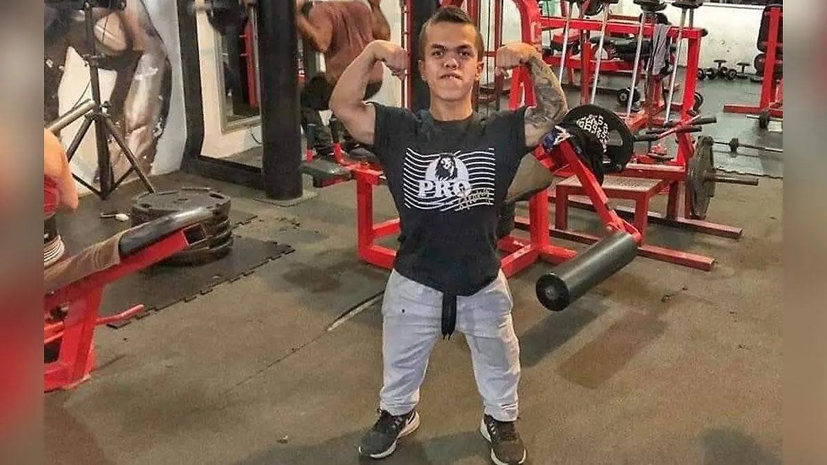 joven con acondroplasia muere 
