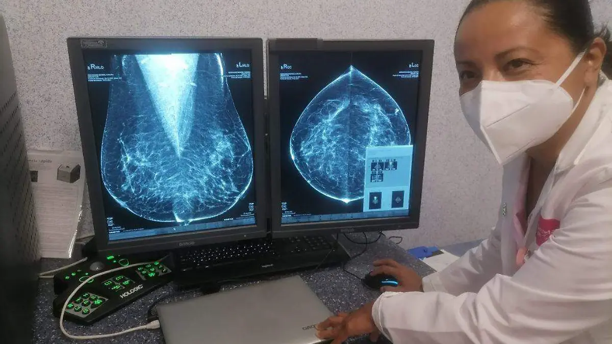 PROMUEVEN ACCIONES DE PREVENCIÓN CONTRA EL CÁNCER DE MAMA 1