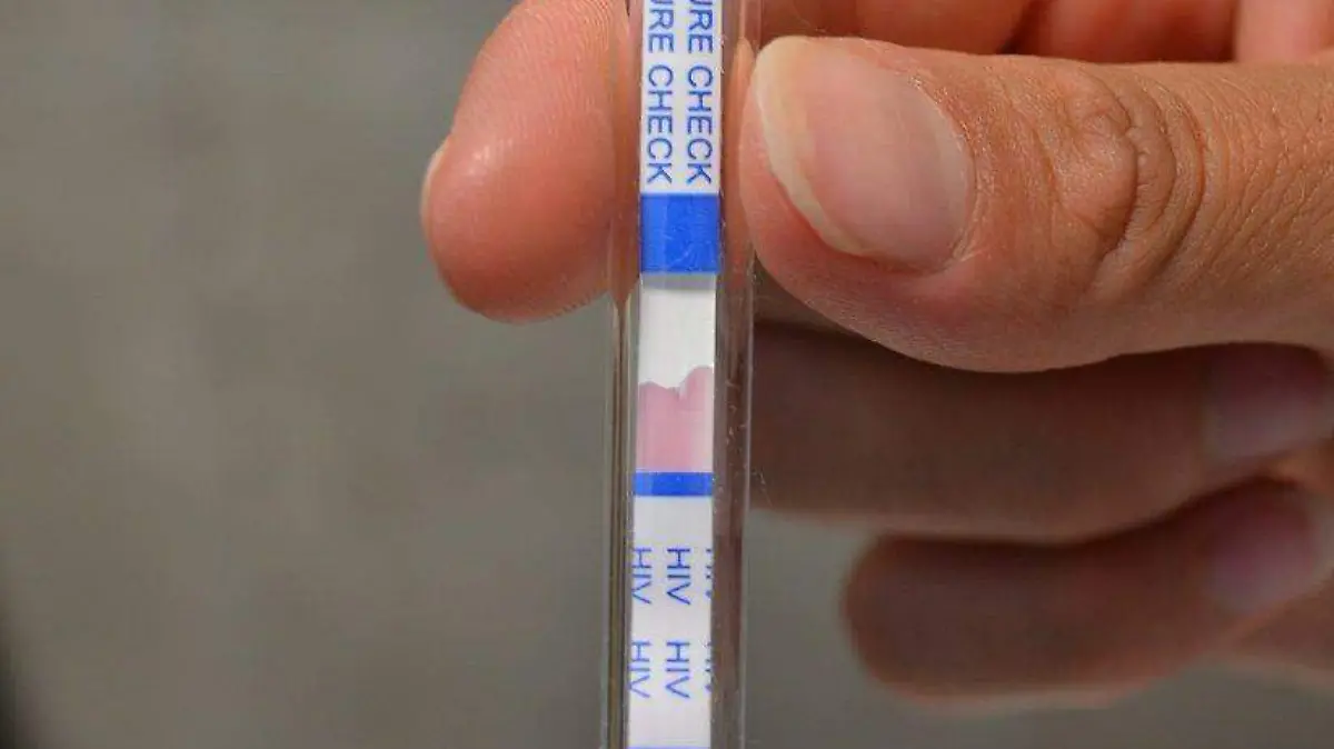 AFECTA VIH MAS A HOMBRES  (2)