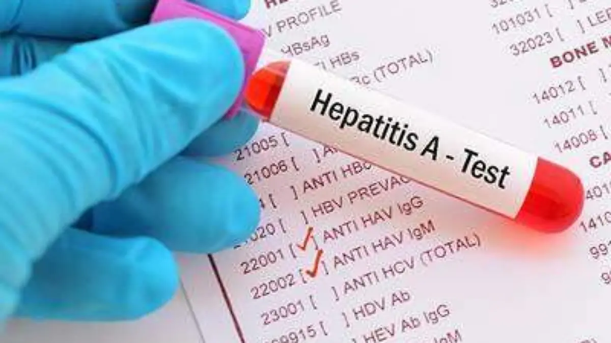 HEPATITIS POCO FRECUENTE EN EL MUNICIPIO 1