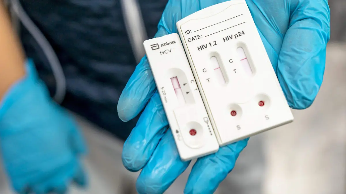 Jornada de pruebas de VIH