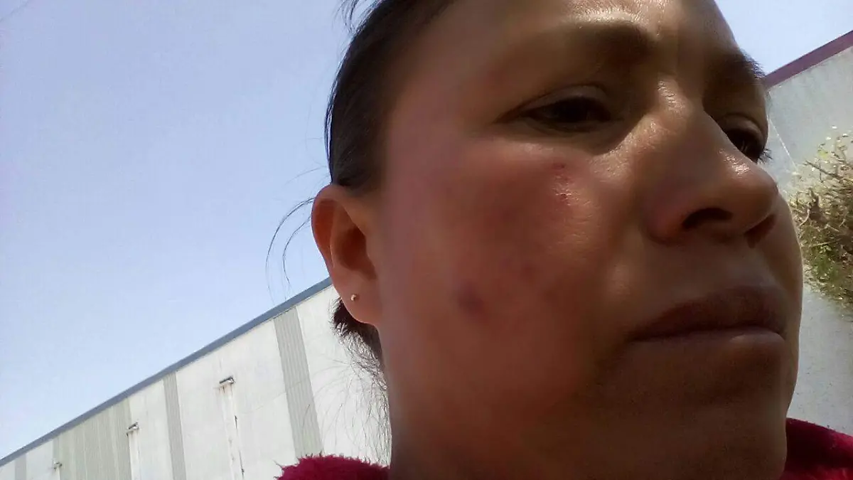 Lilia Bautista Zamora, habitante de la  comunidad de El  Jazmín, agredida por la delegada.