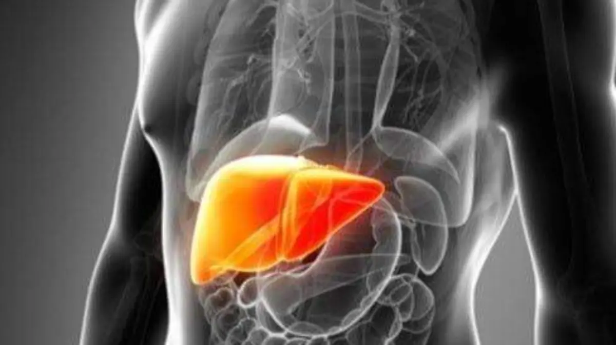 LA hepatitis