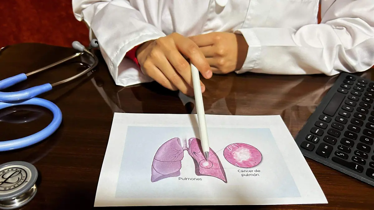 SJR_Existen dos variantes