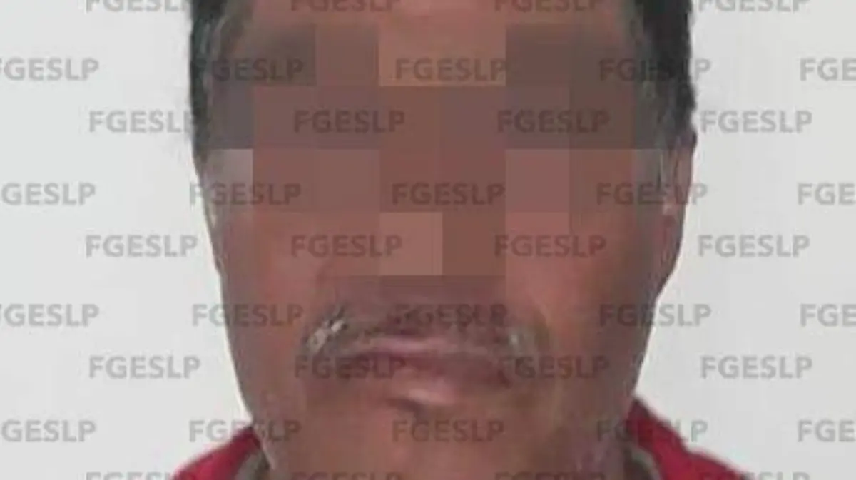 14072020 -- DETENIDO-MOCTEZUMA-LESIONES