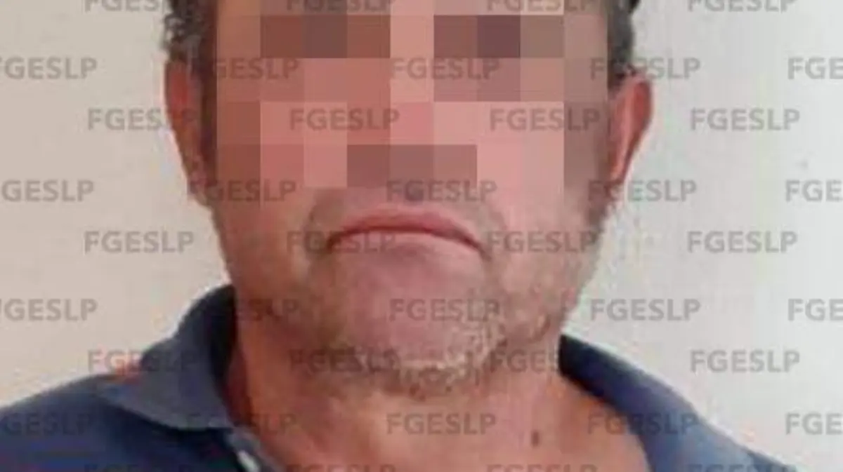15072020_DETENIDO-SGS-LESIONES